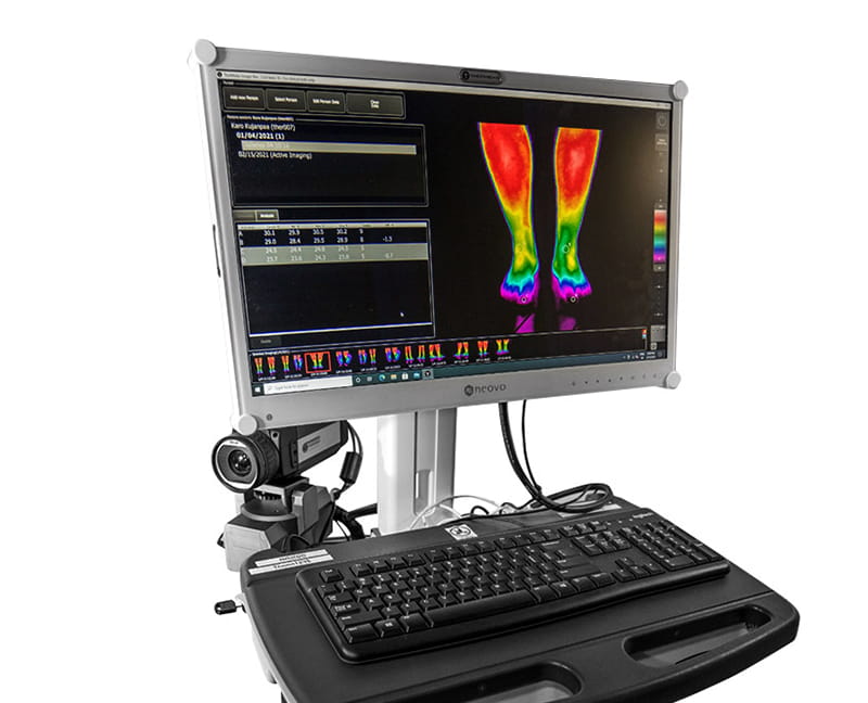 Thermidas clinically validated thermal imaging system