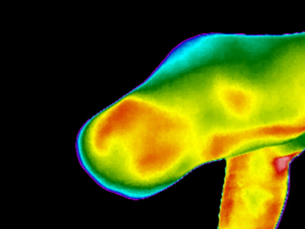 Thermal image of a stump leg